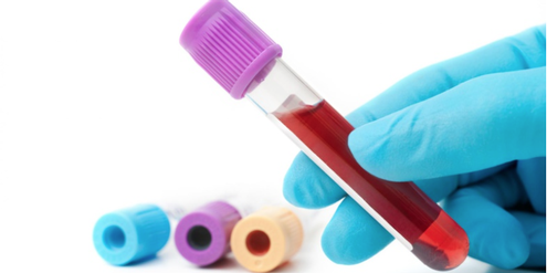 Vorgeburtliche Bluttests sollen invasive Untersuchungen ablösen. Vorgeburtliche Bluttests sollen invasive Untersuchungen ablösen.