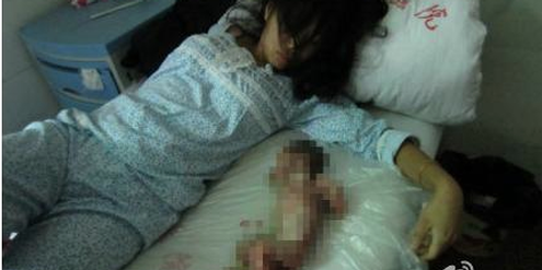 Zwangsabtreibungen – hier im 7. Monat – wird es laut Sheng Keyi in China weiterhin geben. Zwangsabtreibungen – hier im 7. Monat – wird es laut Sheng Keyi in China weiterhin geben.