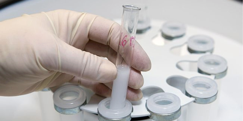 In Italien wurden Reagenzgläser in der Klinik irrtümlich vertauscht. In Italien wurden Reagenzgläser in der Klinik irrtümlich vertauscht.